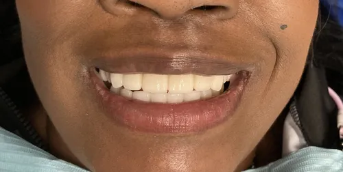 After smile transformation 19