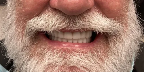 After smile transformation 21