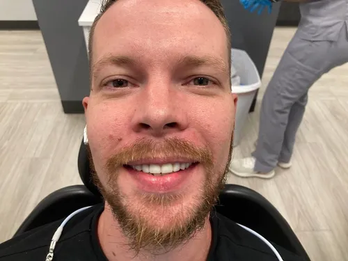 After smile transformation 23