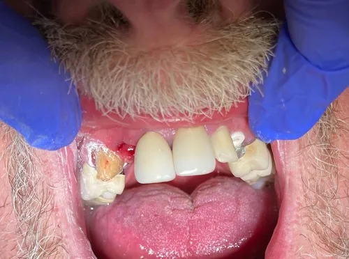 Before smile transformation 12