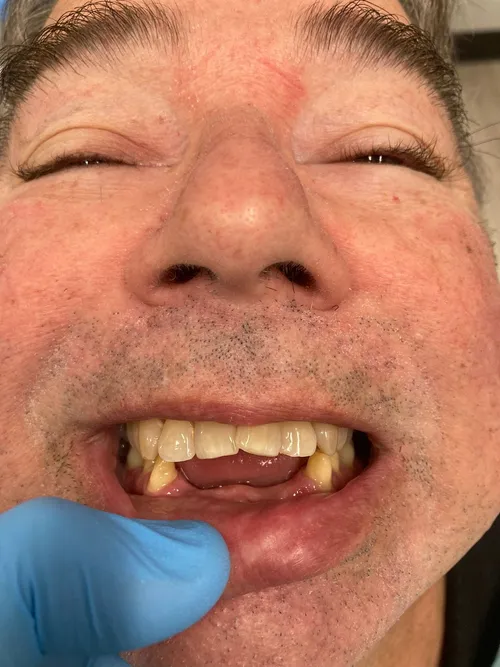 Before smile transformation 18