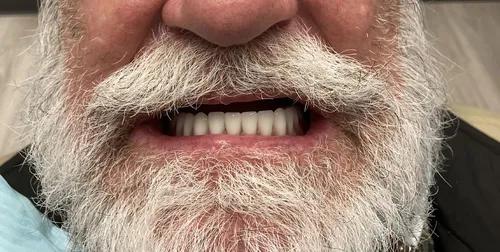 Before smile transformation 21