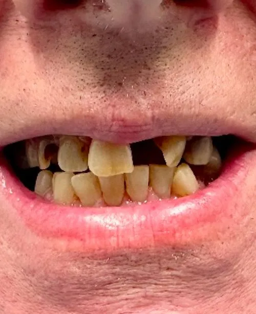 Before smile transformation 7