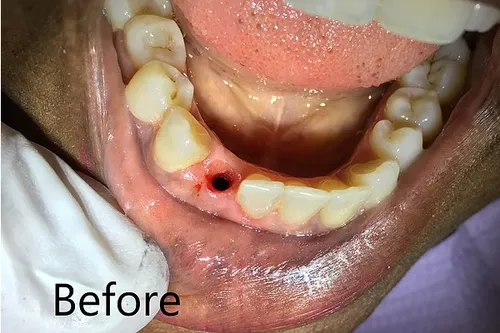 Before smile transformation 9