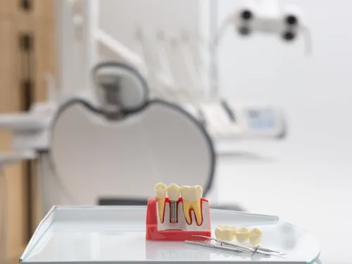 Dental implant patients smiling