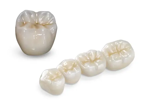Dental bridge at Desoto Dentures and Implants
