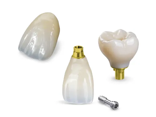 Dental crown restoration at Desoto Dentures and Implants