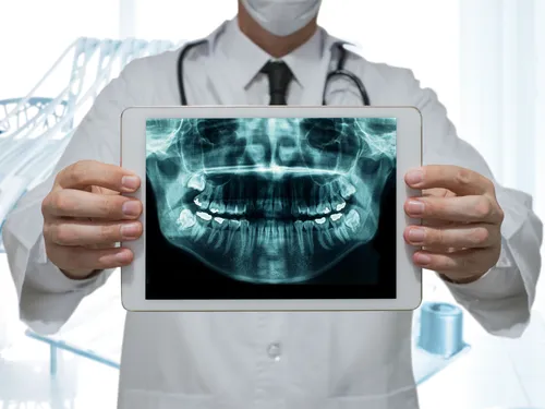 Digital X-rays at [practice_name]