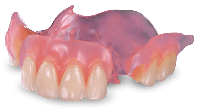 Flexible partial denture example