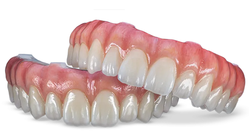 How All-On-X works at Desoto Dentures and Implants