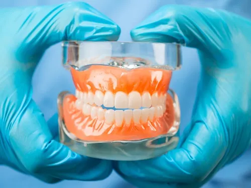 Snap-in implant dentures