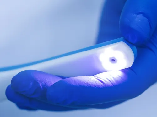 Intraoral camera at [practice_name]