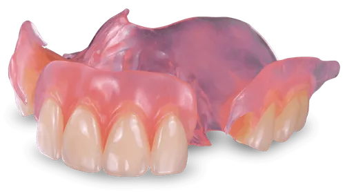 Partial denture example at [practice_name]