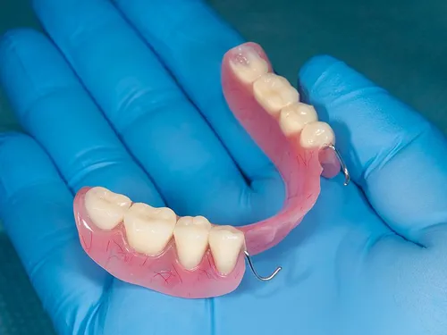 Partial denture held by dental professional