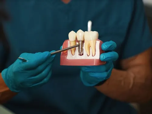 Teeth-in-a-Day at [practice_name]