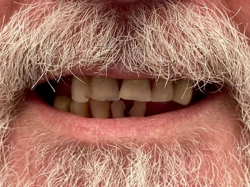 Before: Smile transformation 19