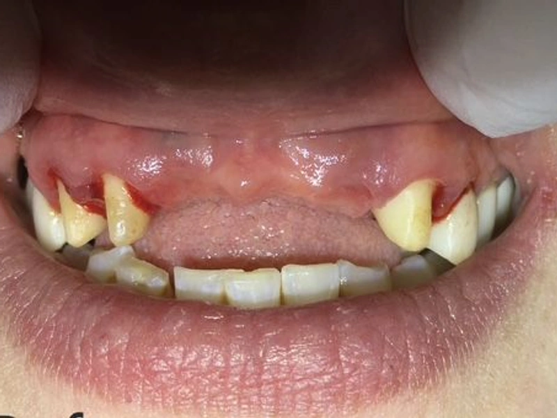 Before: Smile transformation 24
