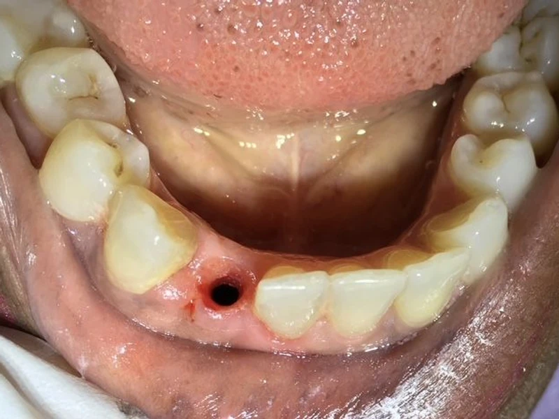 Before: Smile transformation 25