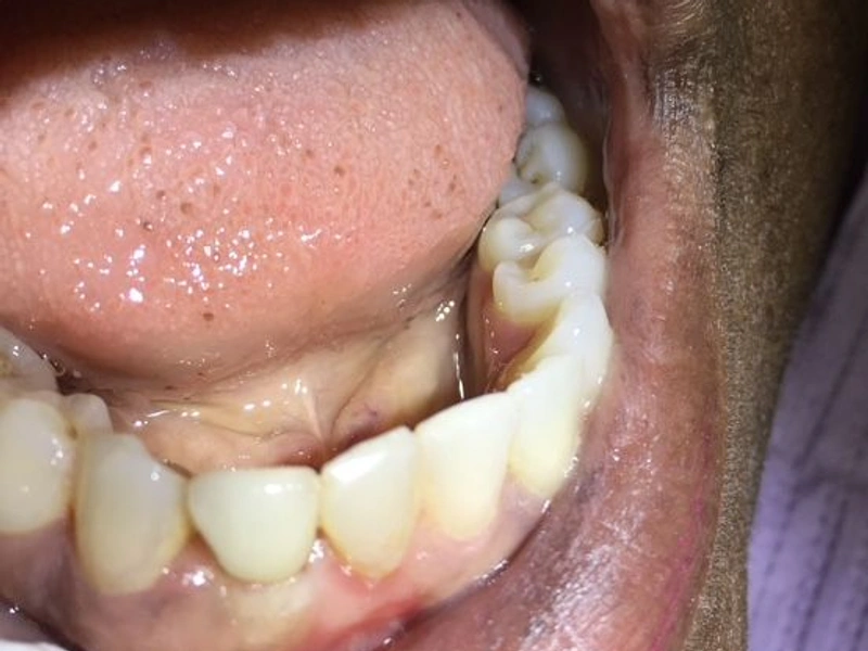After: Smile transformation 25