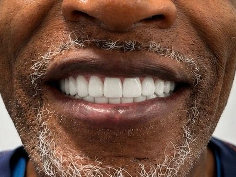 After: Smile transformation 27