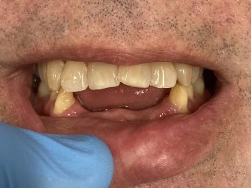 Before: Smile transformation 13